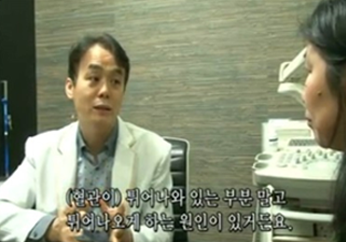 정맥류 발생 부위와 치료 원인을 설명하는 의료진 모습